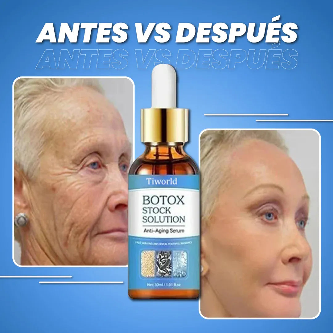 Compre 1 LLEVE 2 - SERUM ANTIARRUGAS BOTÓX – SaludChic Store